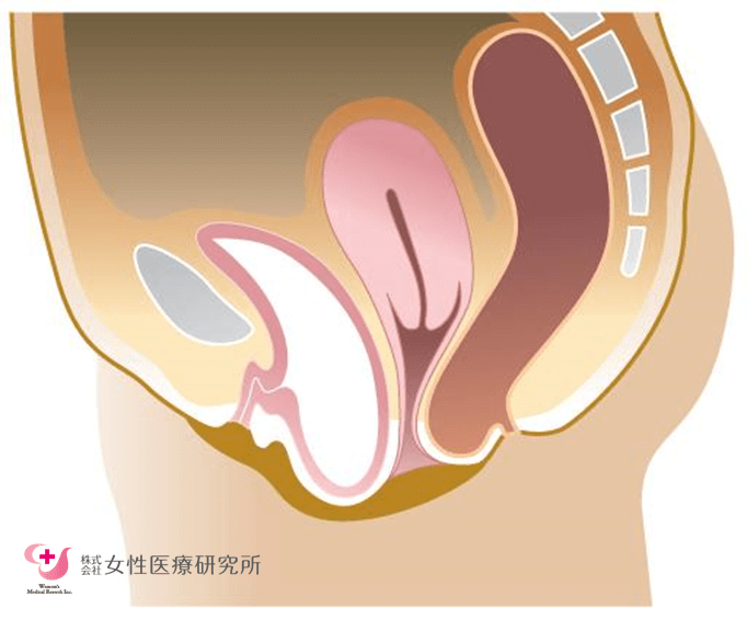 膀胱瘤