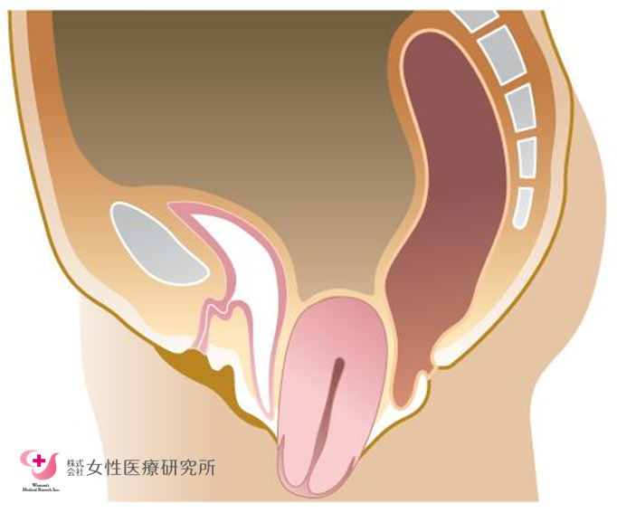 子宮脱